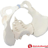 Erler-Zimmer Kreuzbein.