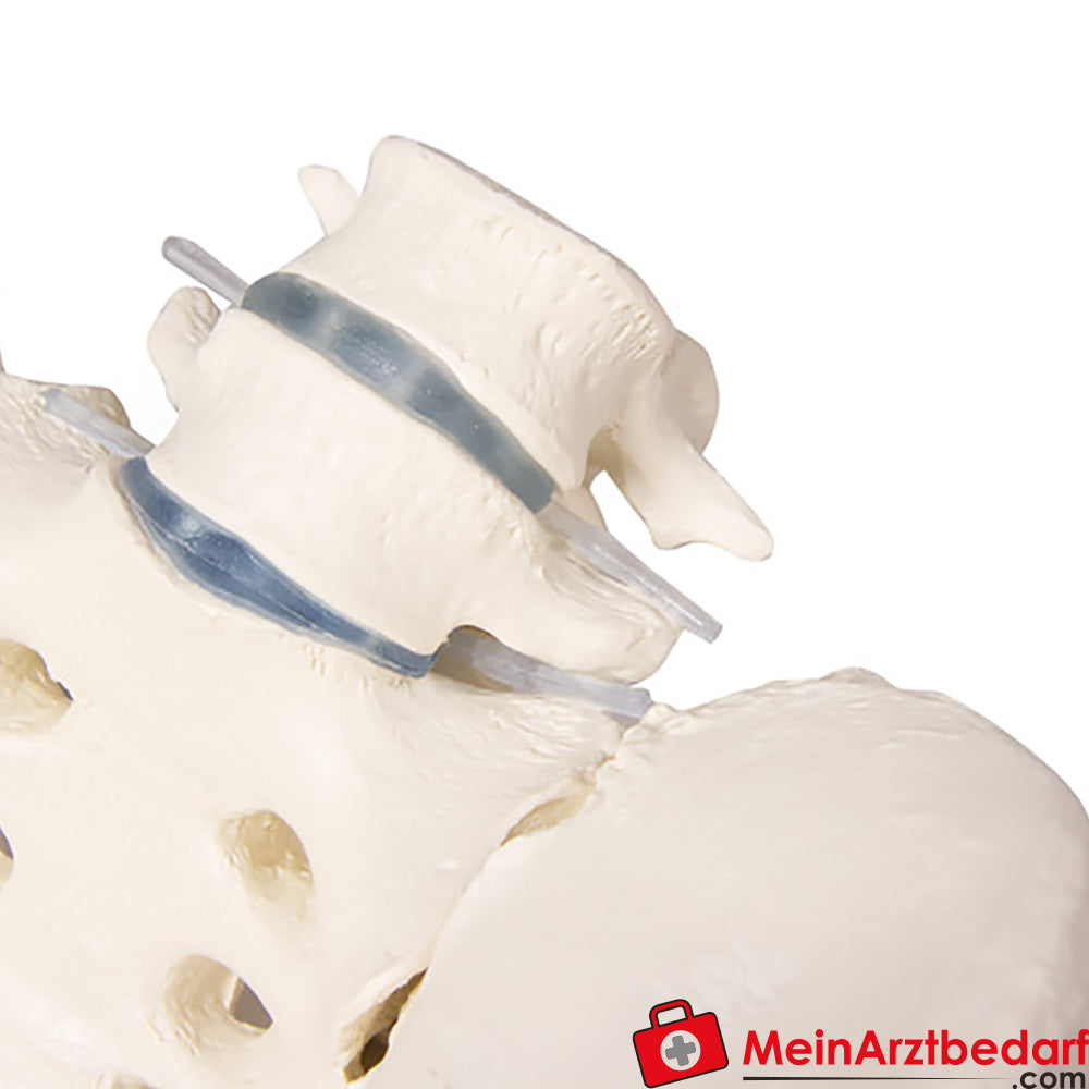 Erler-Zimmer Weibliches Becken.