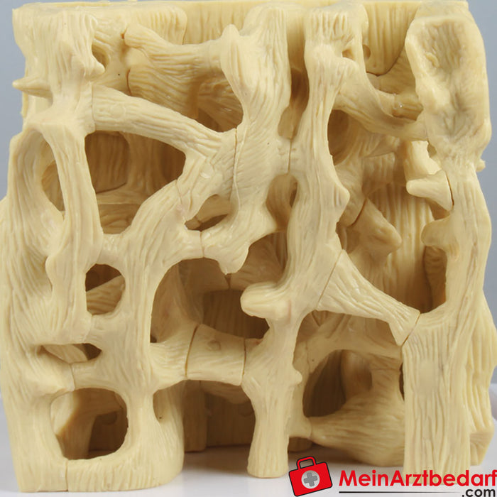 Erler Zimmer Vergleichsmodell gesunde / osteoporotische Knochenstruktur