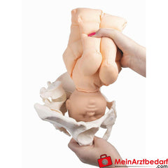 Erler-Zimmer Fetuspuppe.