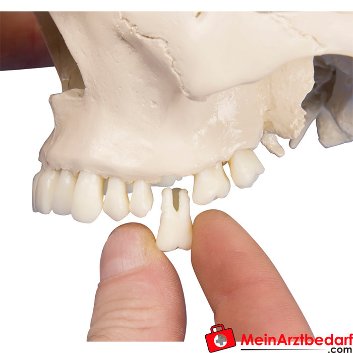 Cráneo dental Erler Zimmer, 4 piezas
