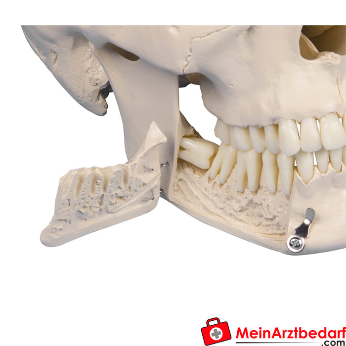 Cráneo dental Erler Zimmer, 4 piezas
