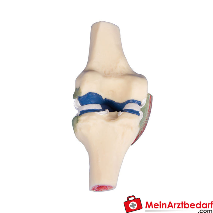 Erler Zimmer Joint section model of the knee
