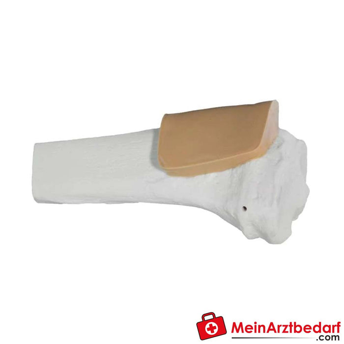 Arrow® EZ-IO® Hueso de Entrenamiento Tibia Adulto