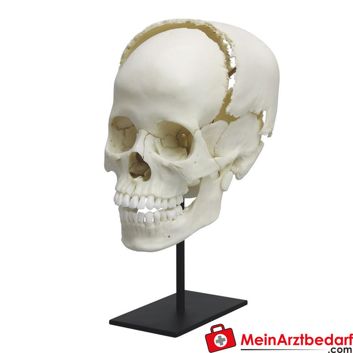 Erler Zimmer Partially assembled human medical study skull