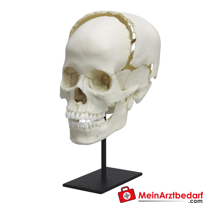 Erler Zimmer Cráneo de estudio médico humano parcialmente ensamblado