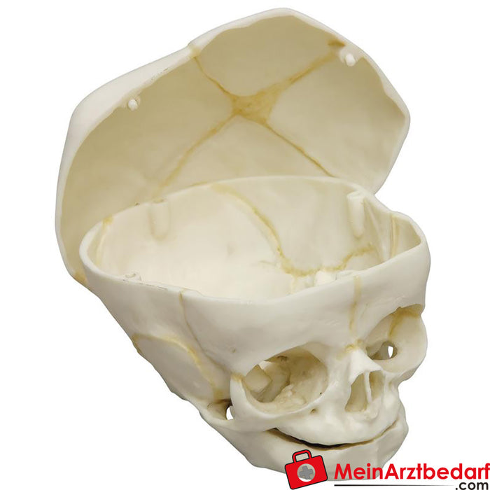 Erler Zimmer Cranio fetale, 40 settimane, con calotta cranica rimovibile