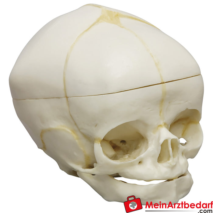 Erler Zimmer Cranio fetale, 40 settimane, con calotta cranica rimovibile