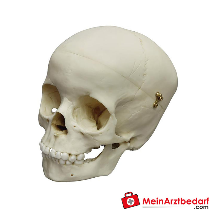 Erler Zimmer Child skull