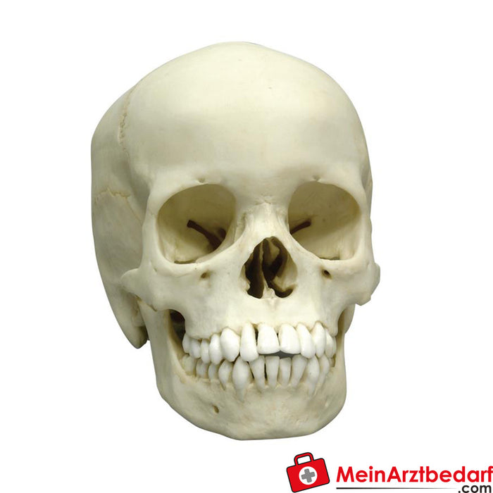 Erler Zimmer Human skull, 13 year old