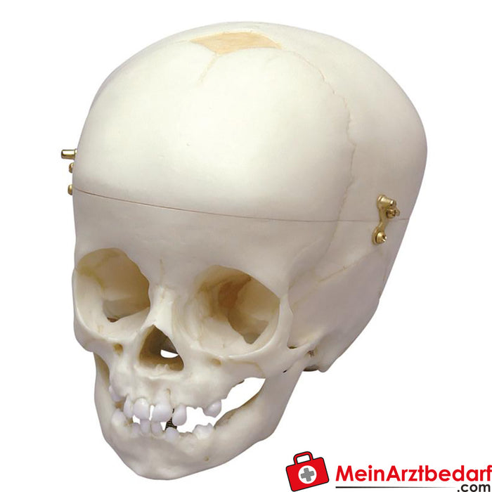 Erler Zimmer Child skull