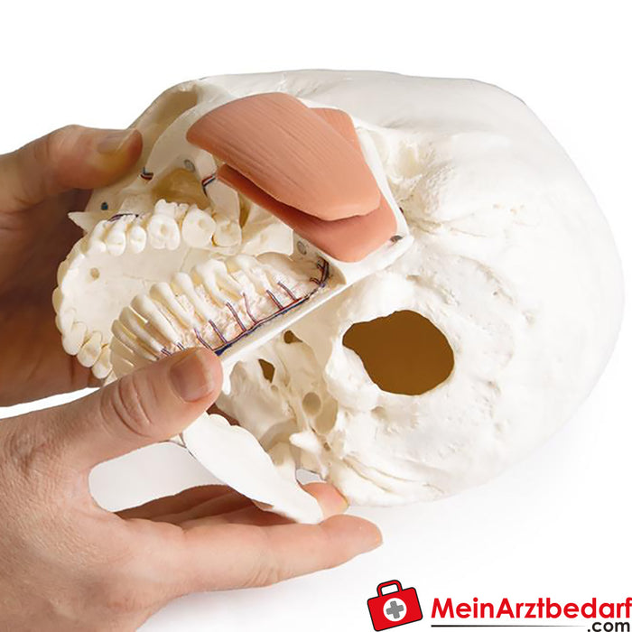 Erler Zimmer Modelo de crânio para odontologia com síndrome CMD, 8 partes