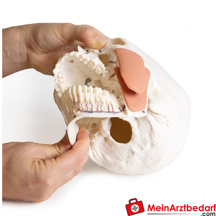 Erler Zimmer Modelo de crânio para odontologia com síndrome CMD, 8 partes