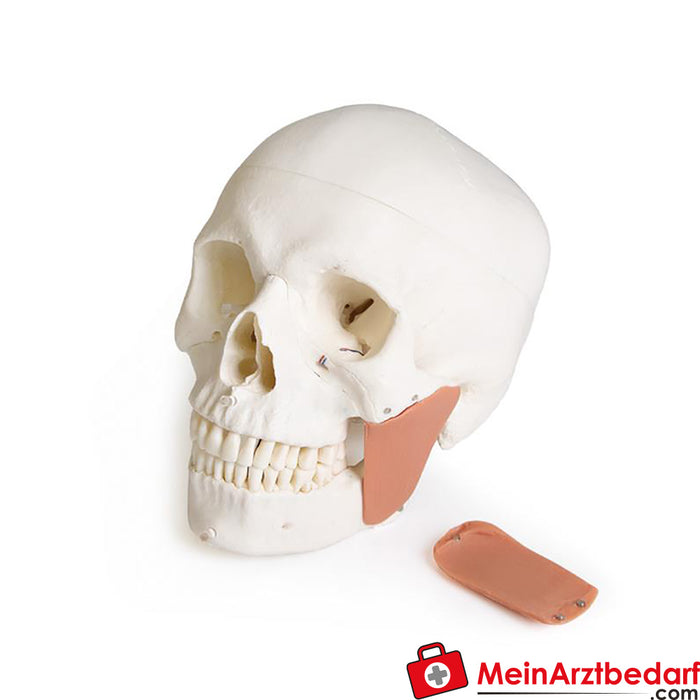 Erler Zimmer Modello di cranio per odontoiatria con sindrome CMD, 8 parti