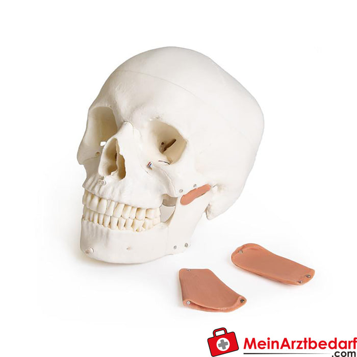 Erler Zimmer Modelo de crânio para odontologia com síndrome CMD, 8 partes