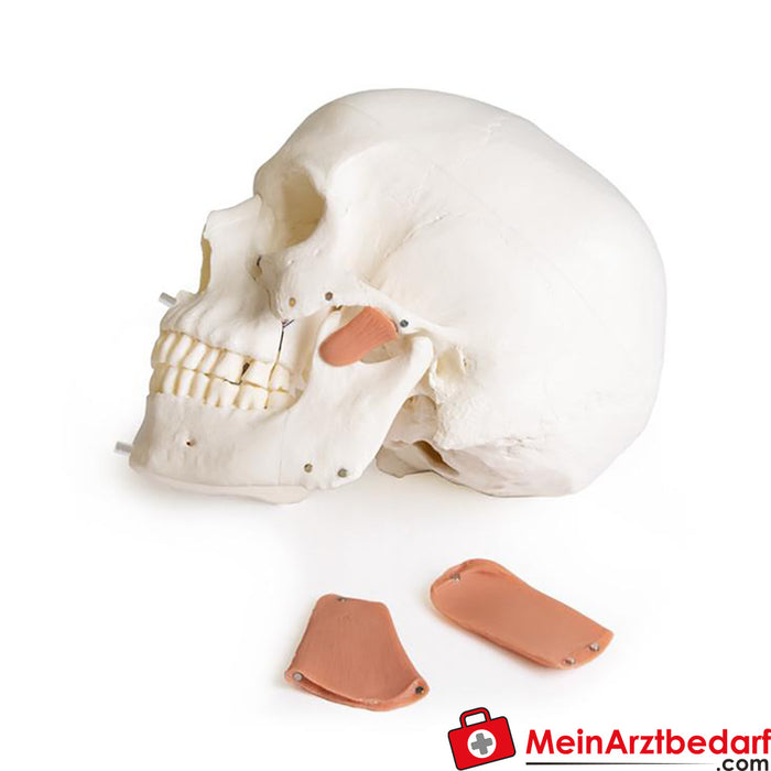 Modelo de cráneo de Erler Zimmer para odontología con síndrome CMD, 8 piezas