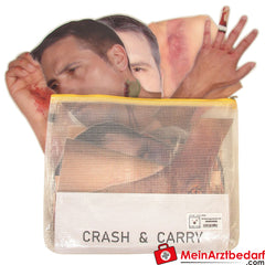 TEE-UU VERLETZUNGSMUSTER Set.