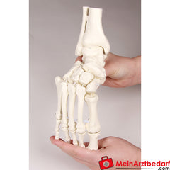 Erler-Zimmer Fußskelett mit Schien.