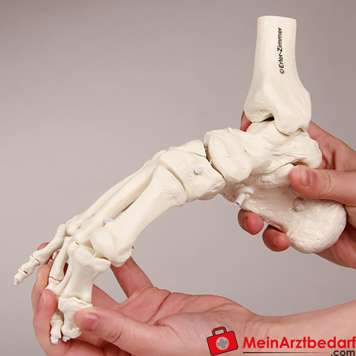 Esqueleto del pie de Erler Zimmer con férula