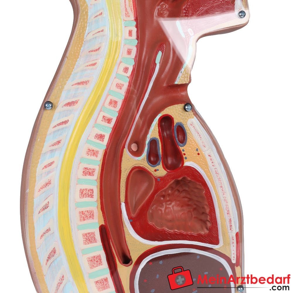 Erler-Zimmer NG Tracheostomie Torso, lebensgroß.