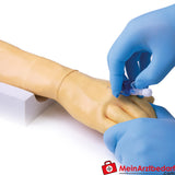 Erler Zimmer Trainingsarm für intravenöse Injektion und Infusion.