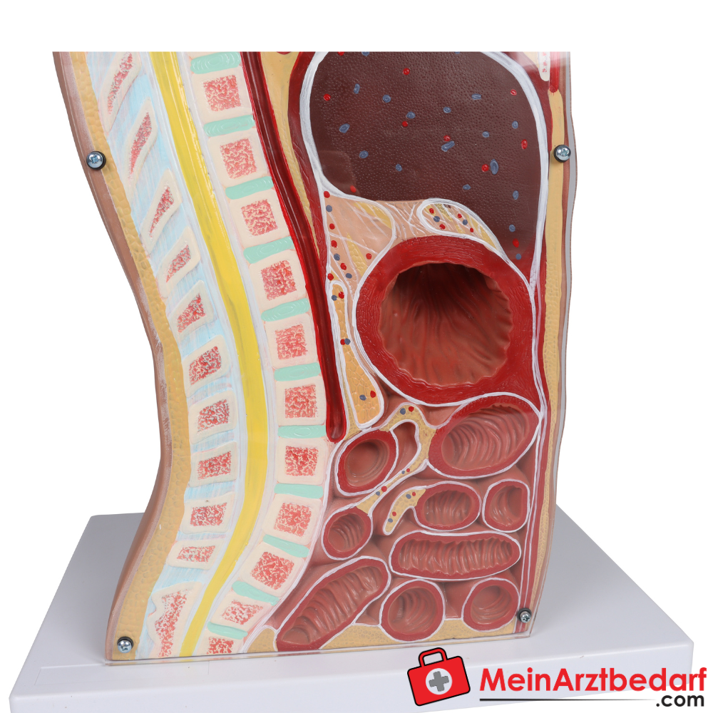 Erler-Zimmer NG Tracheostomie Torso, lebensgroß.