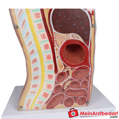Erler-Zimmer NG Tracheostomie Torso, lebensgroß.