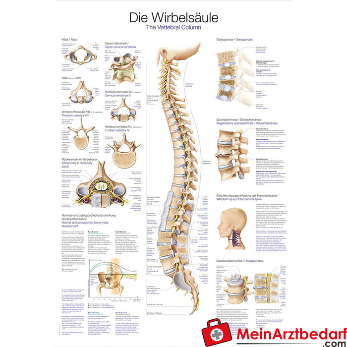 Erler Zimmer Painel didático "A coluna vertebral"