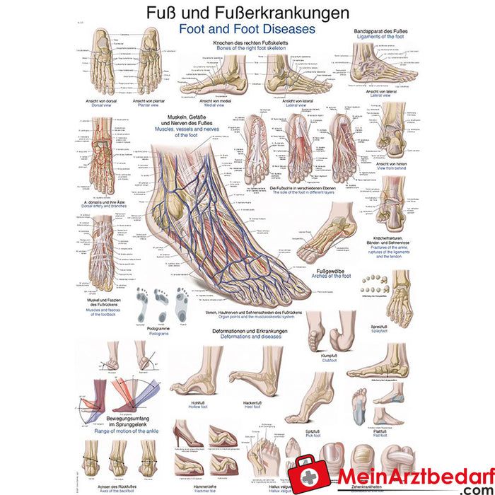 Erler Zimmer Educational panel "Foot and foot diseases