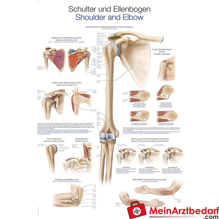 Erler Zimmer Instructional panel "Shoulder and elbow