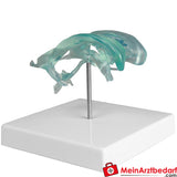 Erler-Zimmer Gehirnventrikel.