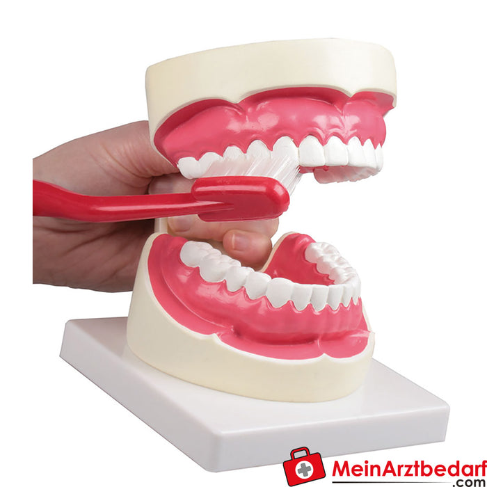 Erler Zimmer Modelo de cuidados dentários - 1,5 vezes o tamanho