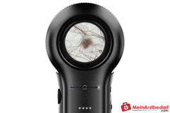 DermLite DL5 Dermatoskop mit variabler Polarisation.