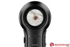 DermLite DL5 Dermatoskop mit variabler Polarisation.