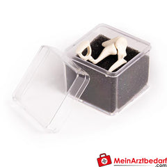 Erler-Zimmer Auditory Ossicles, 3 times life size.