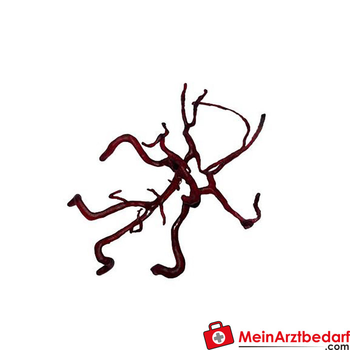 Erler Zimmer Arteries - with aneurysms