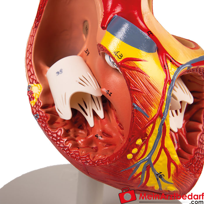 Erler Zimmer kalp modeli, 2 kat gerçek boyutunda, 4 parça