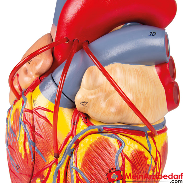 Erler Zimmer Heart with bypass, 2 times life size, 4 parts