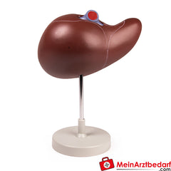 Erler-Zimmer Menschliche Leber, 1,5-fach vergrößert.