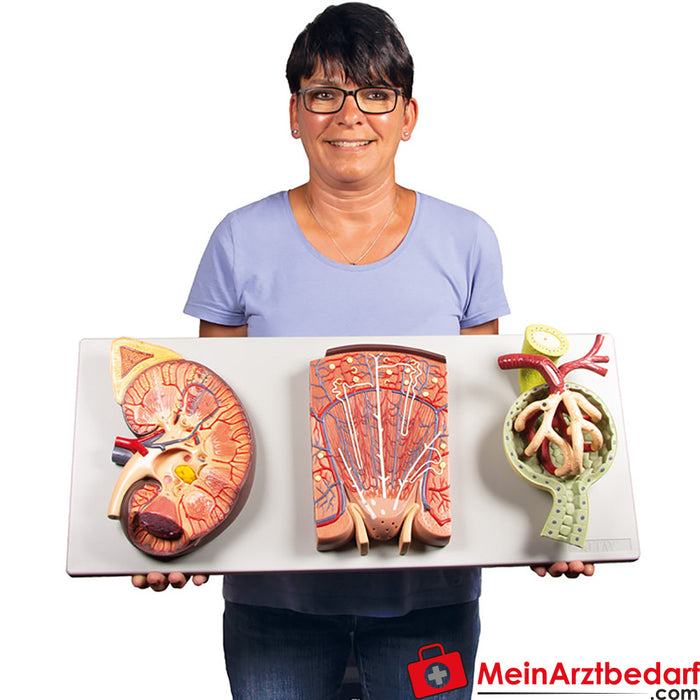 Sección de riñón de Erler Zimmer, nefrona y corpúsculo renal