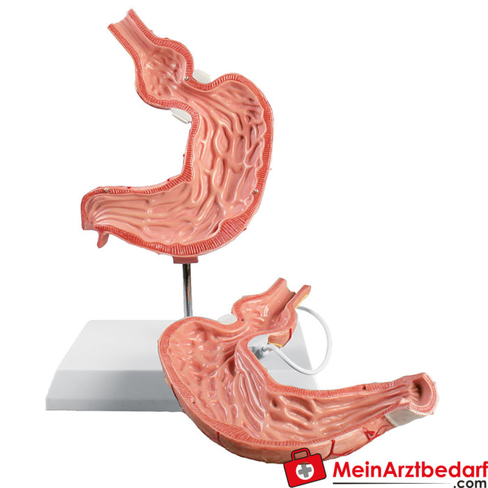 Erler Zimmer Gastric model with gastric band