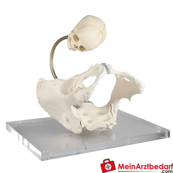 Erler Zimmer 展示分娩过程的骨盆