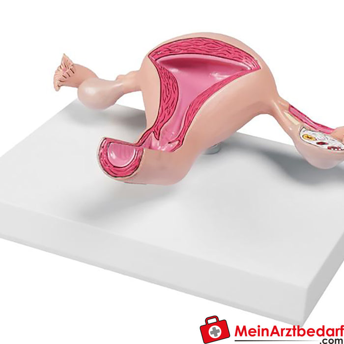 Modelo de útero de Erler Zimmer