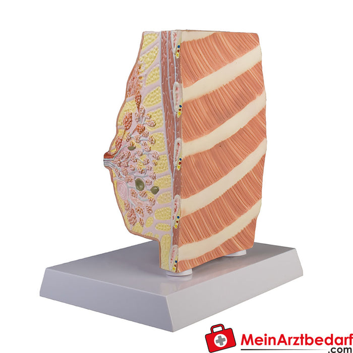 Erler Zimmer Breast cross section with diseases