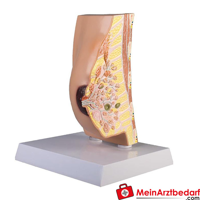 Erler Zimmer Breast cross section with diseases