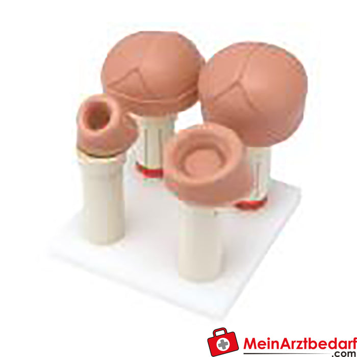 Erler Zimmer Uterine Stages Module