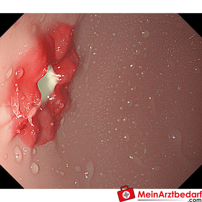 Erler Zimmer Simulador de OGD (esófago-gastro-duodenoscopia)