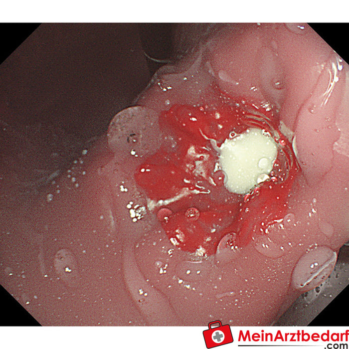 Erler Zimmer Simulatore OGD (esofago-gastro-duodenoscopia)