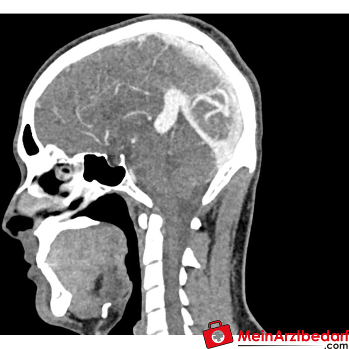 Fantoma de cabeza y cuello Erler Zimmer para CT, rayos X y radioterapia