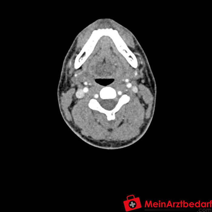 Fantoma de cabeza y cuello Erler Zimmer para CT, rayos X y radioterapia